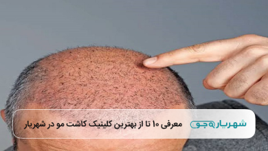 بهترین کلینیک کاشت مو در شهریار