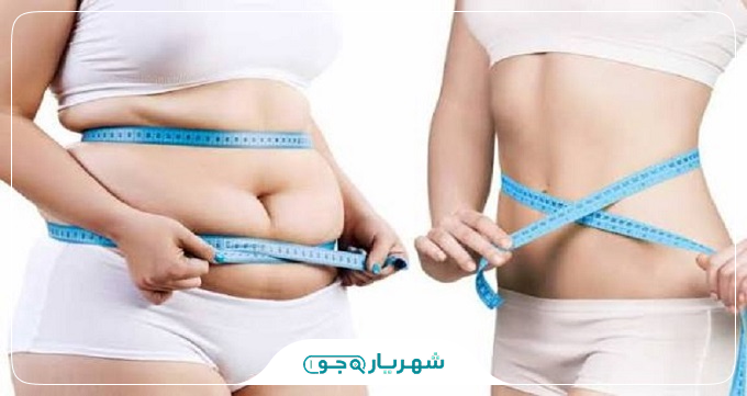 بهترین روشهای لاغری شکم و پهلو در کلینیکها