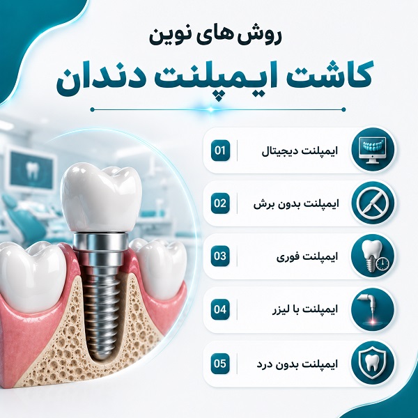 راهنمای انتخاب بهترین متخصص ایمپلنت در شهریار