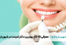 بهترین دکتر لمینت در شهریار